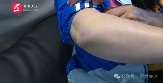 夫妻看房踩空摔伤！经理一句“你是爬过去的”引爆怒火，受伤女子：侮辱人格